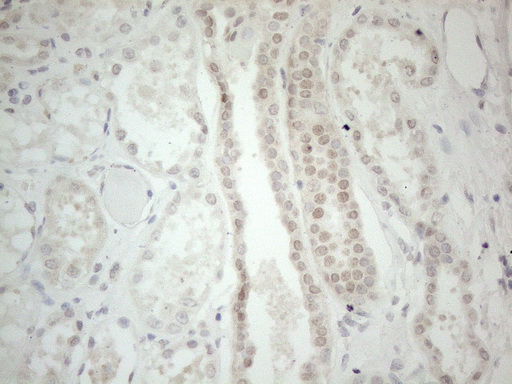 GATA3 Antibody - Immunohistochemical staining of paraffin-embedded Human Kidney tissue using anti-GATA3 mouse monoclonal antibody. (Heat-induced epitope retrieval by 1mM EDTA in 10mM Tris buffer. (pH8.5) at 120°C for 3 min. (1:150)