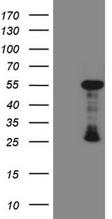 GATA3 Antibody - HEK293T cells were transfected with the pCMV6-ENTRY control. (Left lane) or pCMV6-ENTRY GATA3. (Right lane) cDNA for 48 hrs and lysed