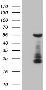 GATA3 Antibody - HEK293T cells were transfected with the pCMV6-ENTRY control. (Left lane) or pCMV6-ENTRY GATA3. (Right lane) cDNA for 48 hrs and lysed. Equivalent amounts of cell lysates. (5 ug per lane) were separated by SDS-PAGE and immunoblotted with anti-GATA3. (1:2000)