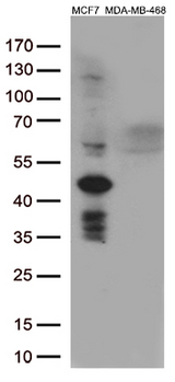 GATA3 Antibody - Western blot analysis of extracts. (35ug) from 3 different cell lines by using anti-GATA3 monoclonal antibody. (1:200)