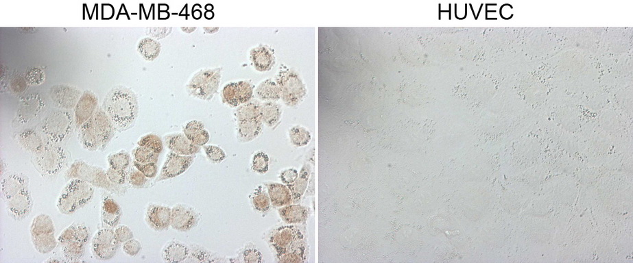 GATA3 Antibody - Immunocytochemistry staining of MDA-MB-468 cells using anti-GATA3 mouse monoclonal antibody. (Left). The right is negative control. (1:5000)