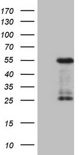 GATA3 Antibody - HEK293T cells were transfected with the pCMV6-ENTRY control. (Left lane) or pCMV6-ENTRY GATA3. (Right lane) cDNA for 48 hrs and lysed. Equivalent amounts of cell lysates. (5 ug per lane) were separated by SDS-PAGE and immunoblotted with anti-GATA3. (1:2000)