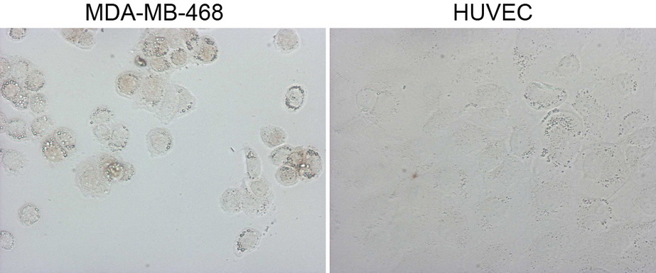 GATA3 Antibody - Immunocytochemistry staining of MDA-MB-468 cells using anti-GATA3 mouse monoclonal antibody. (Left). The right is negative control. (1:10000)