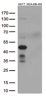GATA3 Antibody - Western blot analysis of extracts. (35ug) from 3 different cell lines by using anti-GATA3 monoclonal antibody. (1:200)