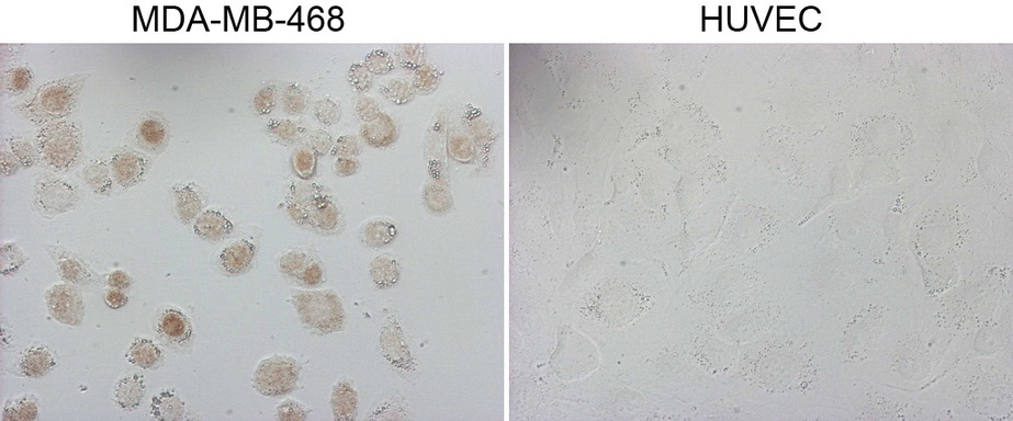 GATA3 Antibody - Immunocytochemistry staining of MDA-MB-468 cells using anti-GATA3 mouse monoclonal antibody. (Left). The right is negative control. (1:1000)