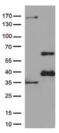 GATA3 Antibody - HEK293T cells were transfected with the pCMV6-ENTRY control. (Left lane) or pCMV6-ENTRY GATA3. (Right lane) cDNA for 48 hrs and lysed. Equivalent amounts of cell lysates. (5 ug per lane) were separated by SDS-PAGE and immunoblotted with anti-GATA3. (1:500)