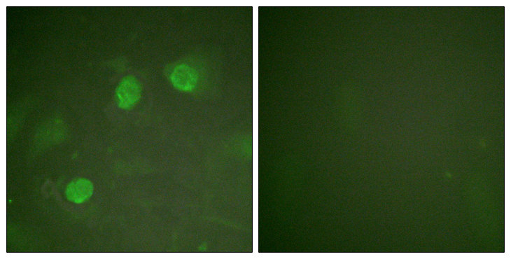 GATA3 Antibody - Immunofluorescence analysis of HeLa cells, using GATA3 Antibody. The picture on the right is blocked with the synthesized peptide.