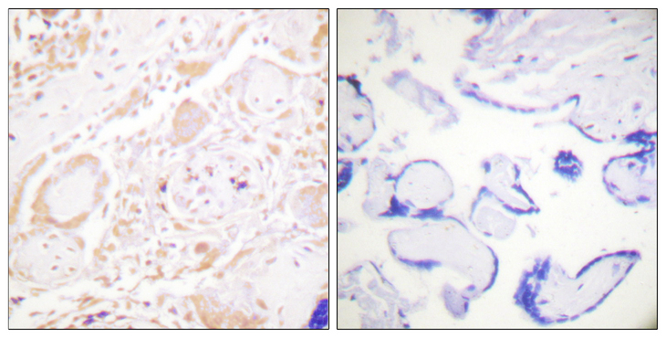 GATA3 Antibody - Immunohistochemistry analysis of paraffin-embedded human placenta tissue, using GATA3 Antibody. The picture on the right is blocked with the synthesized peptide.