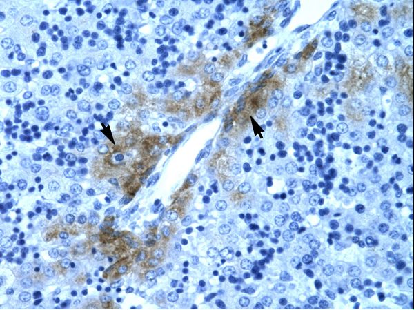GATA3 Antibody - Human Liver.  This image was taken for the unconjugated form of this product. Other forms have not been tested.