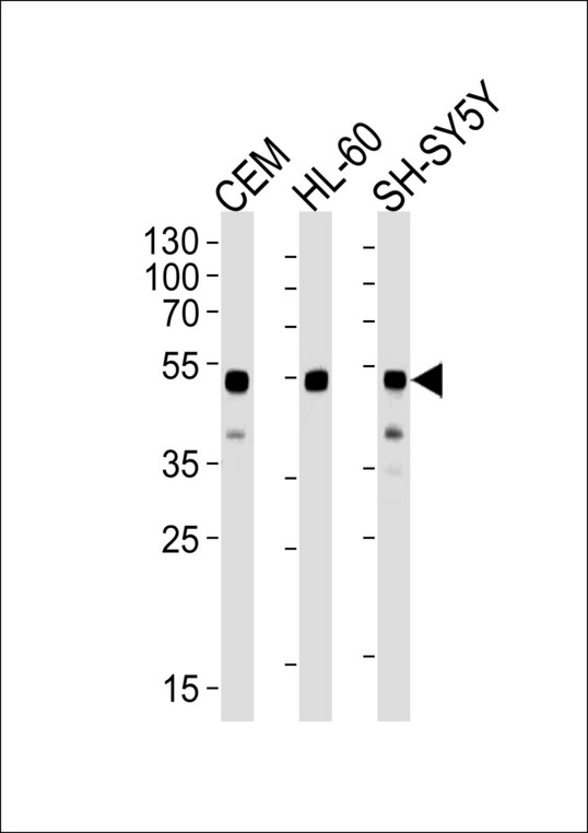 GATA3 Antibody - Western blot of lysates from CEM, HL-60, SH-SY5Y cell lines (from left to right) using GATA3 Antibody. Antibody was diluted at 1:1000 at each lane. A goat anti-mouse IgG H&L (HRP) at 1:3000 dilution was used as the secondary antibody. Lysates at 35 ug per lane.