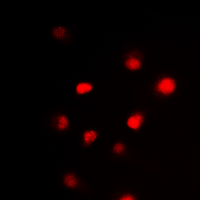 GATA3 Antibody - Immunofluorescent analysis of GATA3 staining in HeLa cells. Formalin-fixed cells were permeabilized with 0.1% Triton X-100 in TBS for 5-10 minutes and blocked with 3% BSA-PBS for 30 minutes at room temperature. Cells were probed with the primary antibody in 3% BSA-PBS and incubated overnight at 4 deg C in a humidified chamber. Cells were washed with PBST and incubated with a DyLight 594-conjugated secondary antibody (red) in PBS at room temperature in the dark. DAPI was used to stain the cell nuclei (blue).