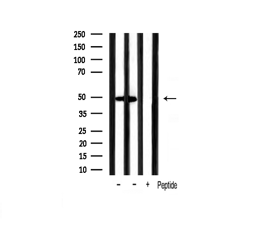 GATA3 Antibody - Western blot analysis of extracts of various smaple using GATA3 antibody.
