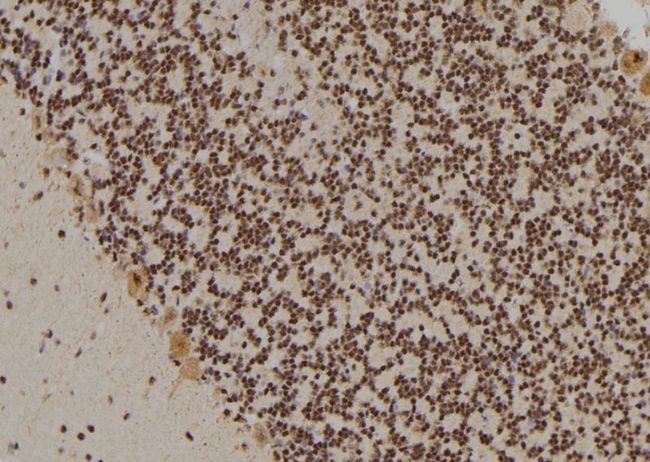 GATA3 Antibody - 1:100 staining rat brain tissue by IHC-P. The sample was formaldehyde fixed and a heat mediated antigen retrieval step in citrate buffer was performed. The sample was then blocked and incubated with the antibody for 1.5 hours at 22°C. An HRP conjugated goat anti-rabbit antibody was used as the secondary.