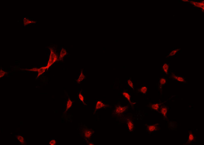 GATA3 Antibody - Staining MCF-7 cells by IF/ICC. The samples were fixed with PFA and permeabilized in 0.1% Triton X-100, then blocked in 10% serum for 45 min at 25°C. The primary antibody was diluted at 1:200 and incubated with the sample for 1 hour at 37°C. An Alexa Fluor 594 conjugated goat anti-rabbit IgG (H+L) antibody, diluted at 1/600, was used as secondary antibody.