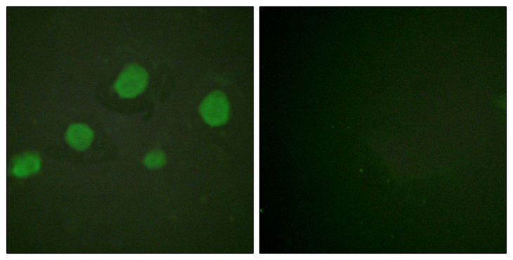 GATA3 Antibody - Immunofluorescence analysis of HUVEC cells, using GATA3 (Phospho-Ser308) Antibody. The picture on the right is blocked with the phospho peptide.