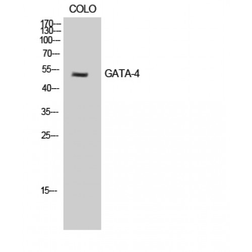 GATA4 Antibody - Western blot of GATA-4 antibody