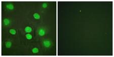 GATA4 Antibody - Immunofluorescence analysis of HUVEC cells, using GATA4 Antibody. The picture on the right is blocked with the synthesized peptide.