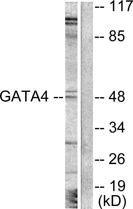 GATA4 Antibody - Western blot analysis of lysates from COLO205 cells, treated with Serum 20% 15', using GATA4 Antibody. The lane on the right is blocked with the synthesized peptide.