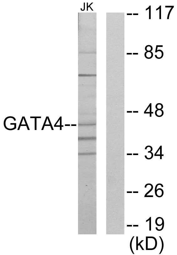 GATA4 Antibody - Western blot analysis of lysates from Jurkat cells, using GATA4 Antibody. The lane on the right is blocked with the synthesized peptide.