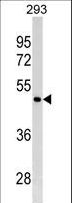 GATA4 Antibody - GATA4 Antibody (Ascites)western blot of 293 cell line lysates (35 ug/lane). The GATA4 antibody detected the GATA4 protein (arrow).
