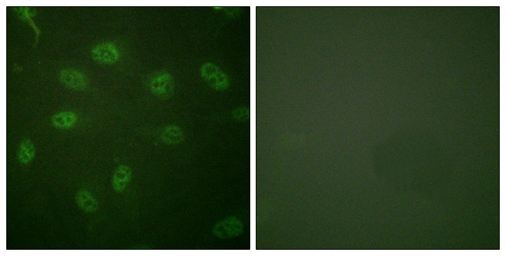 GATA4 Antibody - Immunofluorescence analysis of HeLa cells, using GATA4 Antibody. The picture on the right is blocked with the synthesized peptide.