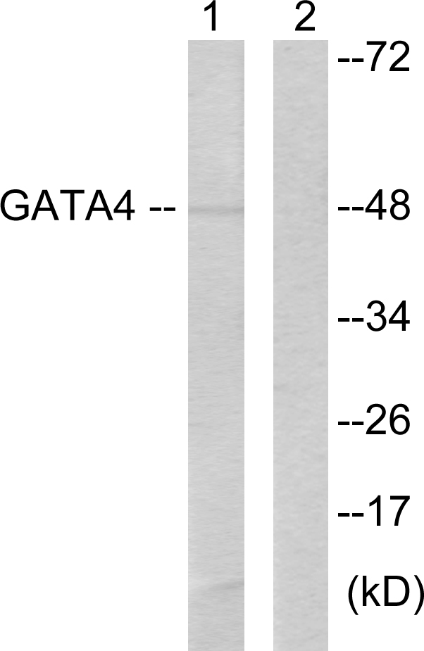 GATA4 Antibody - Western blot analysis of lysates from HeLa cells, using GATA4 Antibody. The lane on the right is blocked with the synthesized peptide.