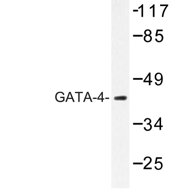 GATA4 Antibody - Western blot of GATA-4 (R306) pAb in extracts from Jurkat cells.