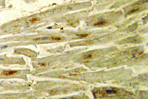 GATA4 Antibody - IHC of GATA-4 (R306) pAb in paraffin-embedded human heart tissue.