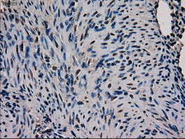 GATA4 Antibody - IHC of paraffin-embedded Human endometrium tissue using anti-GATA4 mouse monoclonal antibody.