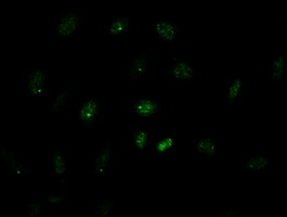 GATA4 Antibody - Immunofluorescent staining of HeLa cells using anti-GATA4 mouse monoclonal antibody.