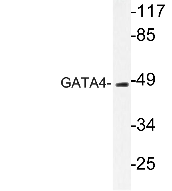 GATA4 Antibody - Western blot of GATA4 (Q258) pAb in extracts from COLO205 cells.