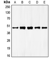 GATA4 Antibody - Western blot analysis of GATA4 expression in HepG2 (A); NIH3T3 (B); mouse liver (C); rat liver (D); rat kidney (E) whole cell lysates.