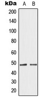 GATA4 Antibody - Western blot analysis of GATA4 expression in HepG2 (A); HeLa (B) whole cell lysates.