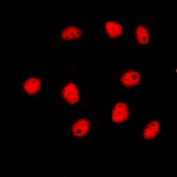 GATA4 Antibody - Immunofluorescent analysis of GATA4 staining in HepG2 cells. Formalin-fixed cells were permeabilized with 0.1% Triton X-100 in TBS for 5-10 minutes and blocked with 3% BSA-PBS for 30 minutes at room temperature. Cells were probed with the primary antibody in 3% BSA-PBS and incubated overnight at 4 C in a humidified chamber. Cells were washed with PBST and incubated with a DyLight 594-conjugated secondary antibody (red) in PBS at room temperature in the dark. DAPI was used to stain the cell nuclei (blue).