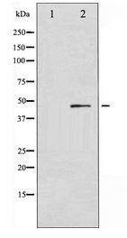 GATA4 Antibody - Western blot of GATA4 expression in Serum treated COLO205 whole cell lysates,The lane on the left is treated with the antigen-specific peptide.