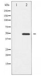 GATA4 Antibody - Western blot of GATA4 expression in HeLa whole cell lysates,The lane on the left is treated with the antigen-specific peptide.
