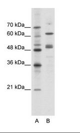 GATA4 Antibody - A: Marker, B: Jurkat Cell Lysate.  This image was taken for the unconjugated form of this product. Other forms have not been tested.
