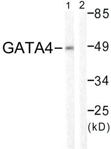 GATA4 Antibody - Western blot analysis of extracts from HeLa cells, using GATA4 (Ab-105) antibody.