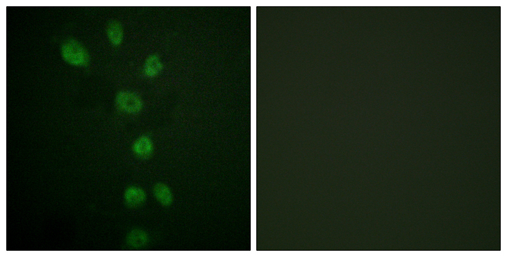 GATA4 Antibody - Immunofluorescence analysis of HepG2 cells, using GATA4 (Phospho-Ser105) Antibody. The picture on the right is blocked with the phospho peptide.