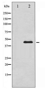 GATA4 Antibody - Western blot of GATA4 phosphorylation expression in HepG2 whole cell lysates,The lane on the left is treated with the antigen-specific peptide.