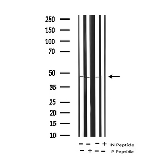 GATA4 Antibody - Western blot analysis of Phospho-GATA4 (Ser105) expression in various lysates