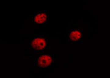 GATA4 Antibody - Staining HepG2 cells by IF/ICC. The samples were fixed with PFA and permeabilized in 0.1% saponin prior to blocking in 10% serum for 45 min at 37°C. The primary antibody was diluted 1/400 and incubated with the sample for 1 hour at 37°C. A Alexa Fluor 594 conjugated goat polyclonal to rabbit IgG (H+L), diluted 1/600 was used as secondary antibody.
