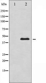 GATA4 Antibody - Western blot analysis of GATA4 phosphorylation expression in HepG2 whole cells lysates. The lane on the left is treated with the antigen-specific peptide.