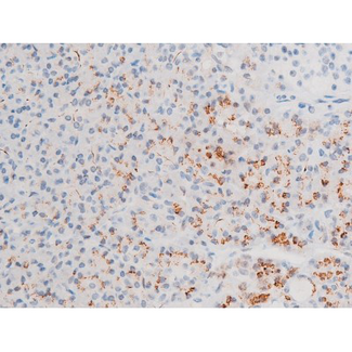 GATA4 Antibody - 1:200 staining human pancreas tissue by IHC-P. The tissue was formaldehyde fixed and a heat mediated antigen retrieval step in citrate buffer was performed. The tissue was then blocked and incubated with the antibody for 1.5 hours at 22°C. An HRP conjugated goat anti-rabbit antibody was used as the secondary.