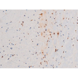 GATA4 Antibody - 1:200 staining mouse brain tissue by IHC-P. The tissue was formaldehyde fixed and a heat mediated antigen retrieval step in citrate buffer was performed. The tissue was then blocked and incubated with the antibody for 1.5 hours at 22°C. An HRP conjugated goat anti-rabbit antibody was used as the secondary.