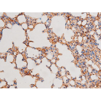GATA4 Antibody - 1:200 staining mouse lung tissue by IHC-P. The tissue was formaldehyde fixed and a heat mediated antigen retrieval step in citrate buffer was performed. The tissue was then blocked and incubated with the antibody for 1.5 hours at 22°C. An HRP conjugated goat anti-rabbit antibody was used as the secondary.