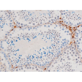 GATA4 Antibody - 1:200 staining mouse testis tissue by IHC-P. The tissue was formaldehyde fixed and a heat mediated antigen retrieval step in citrate buffer was performed. The tissue was then blocked and incubated with the antibody for 1.5 hours at 22°C. An HRP conjugated goat anti-rabbit antibody was used as the secondary.