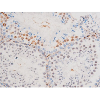 GATA4 Antibody - 1:200 staining mouse testis tissue by IHC-P. The tissue was formaldehyde fixed and a heat mediated antigen retrieval step in citrate buffer was performed. The tissue was then blocked and incubated with the antibody for 1.5 hours at 22°C. An HRP conjugated goat anti-rabbit antibody was used as the secondary.