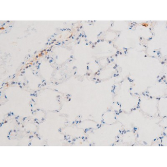 GATA4 Antibody - 1:200 staining rat lung tissue by IHC-P. The tissue was formaldehyde fixed and a heat mediated antigen retrieval step in citrate buffer was performed. The tissue was then blocked and incubated with the antibody for 1.5 hours at 22°C. An HRP conjugated goat anti-rabbit antibody was used as the secondary.