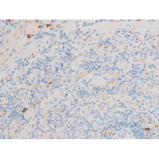 GATA4 Antibody - 1:200 staining rat spleen tissue by IHC-P. The tissue was formaldehyde fixed and a heat mediated antigen retrieval step in citrate buffer was performed. The tissue was then blocked and incubated with the antibody for 1.5 hours at 22°C. An HRP conjugated goat anti-rabbit antibody was used as the secondary.